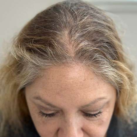 A high-angle close-up of a person's head showing natural, graying hair parting along the top of the scalp.