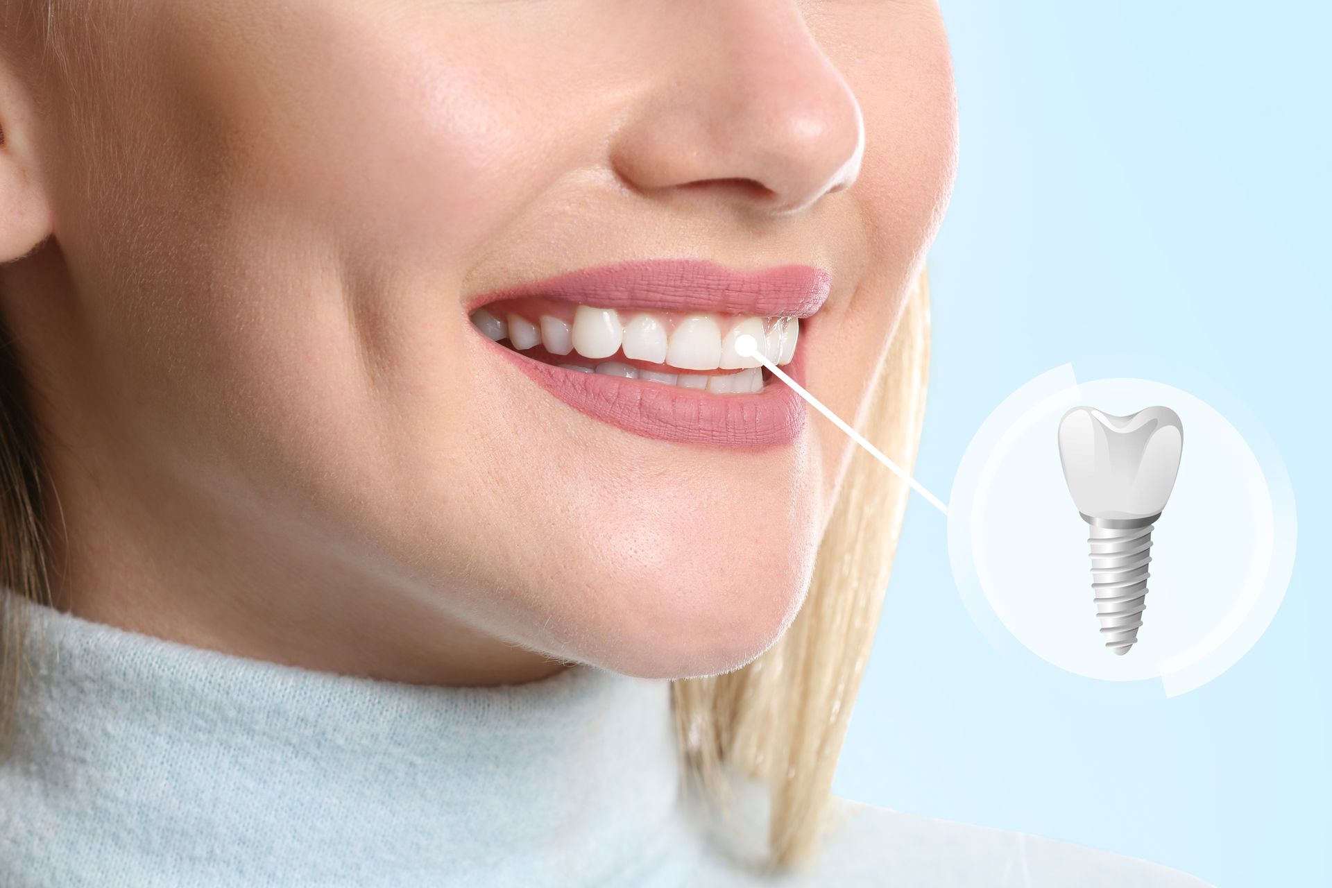 A close up of a woman 's smile with a dental implant in the background.