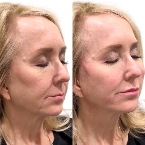 before and after image
