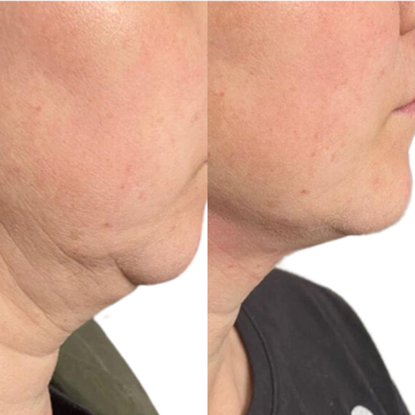 before and after image