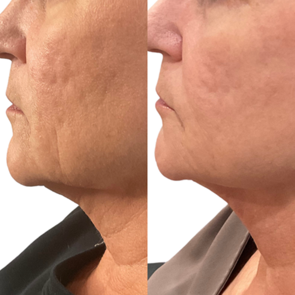 before and after image