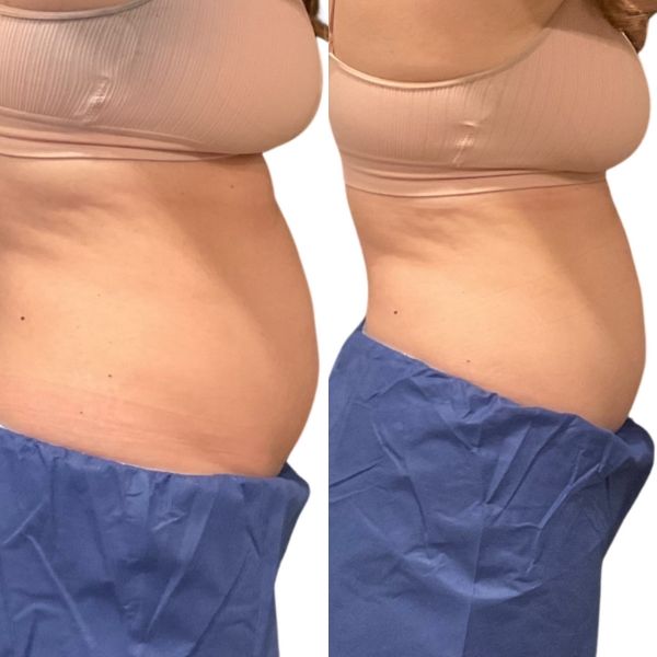 before and after image