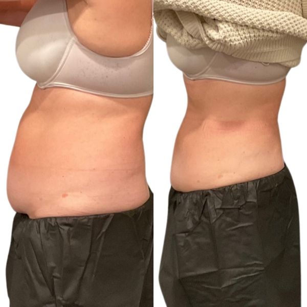 before and after image