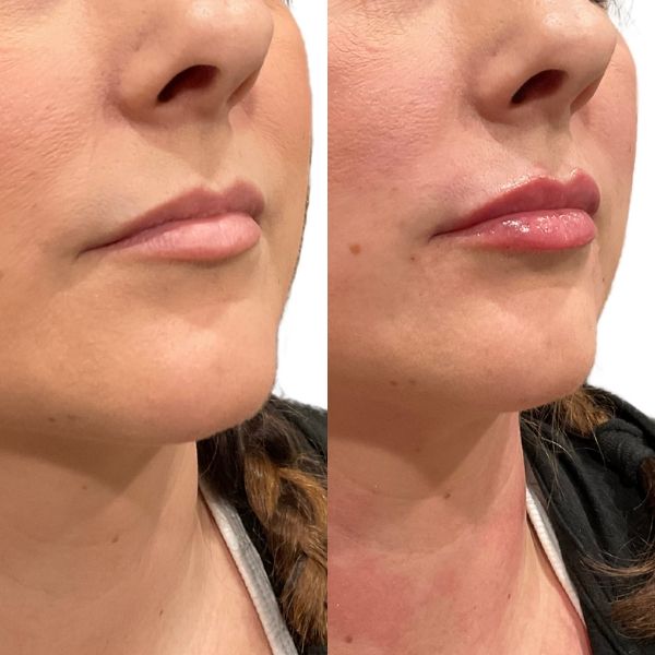 before and after