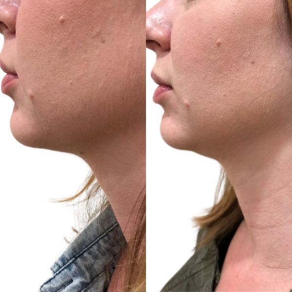 before and after image
