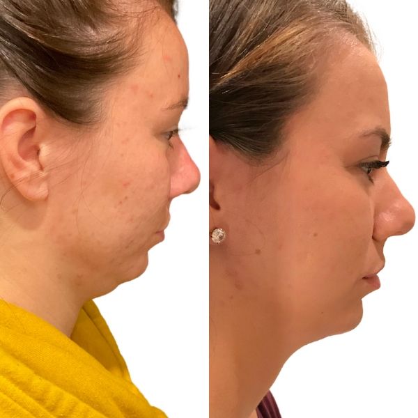 before and after image