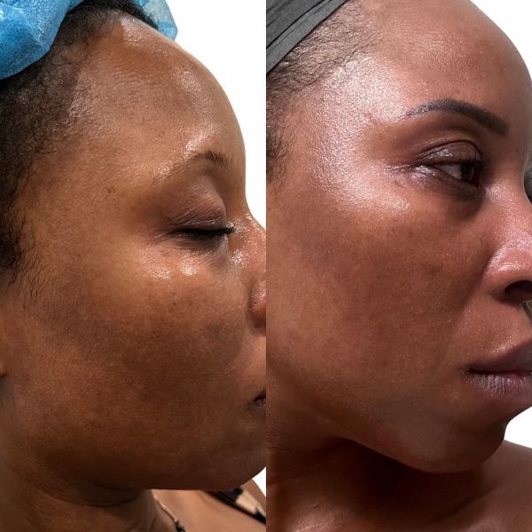 before and after image