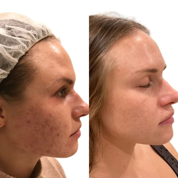 before and after image
