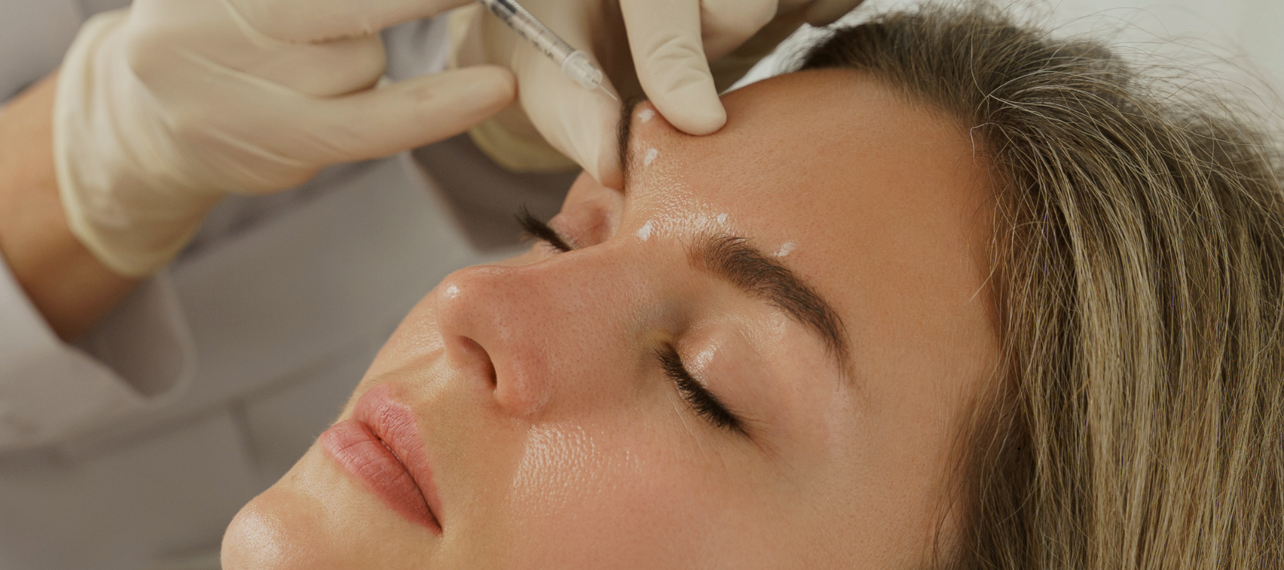 Patient getting botox injected into the forehead with a needle