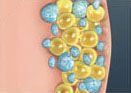 coolsculpting elite