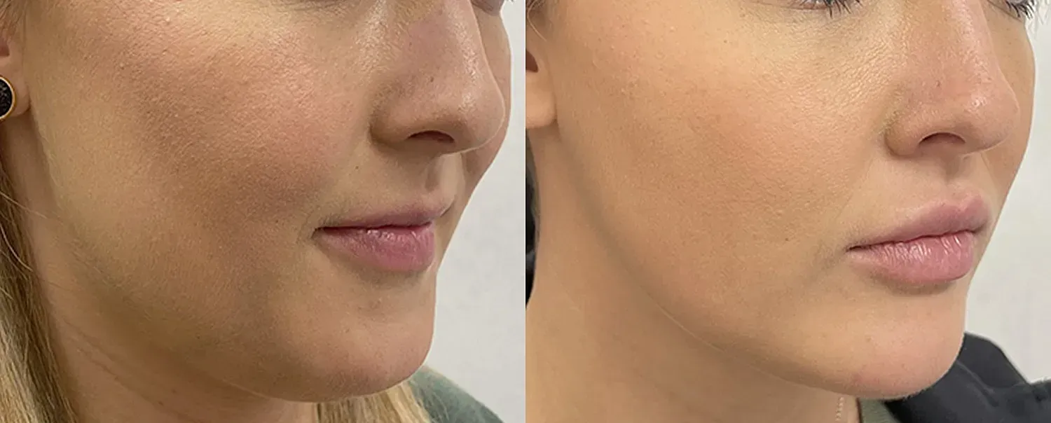 before and after image