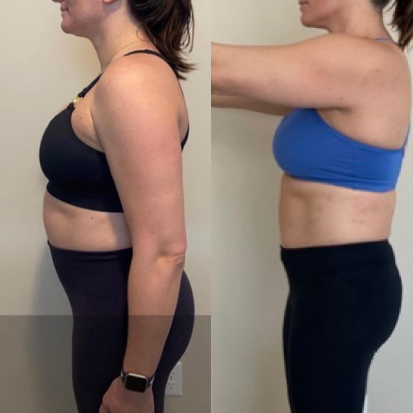Side-by-side side profile photos of a person before and after, wearing black and blue sports bras and black leggings.