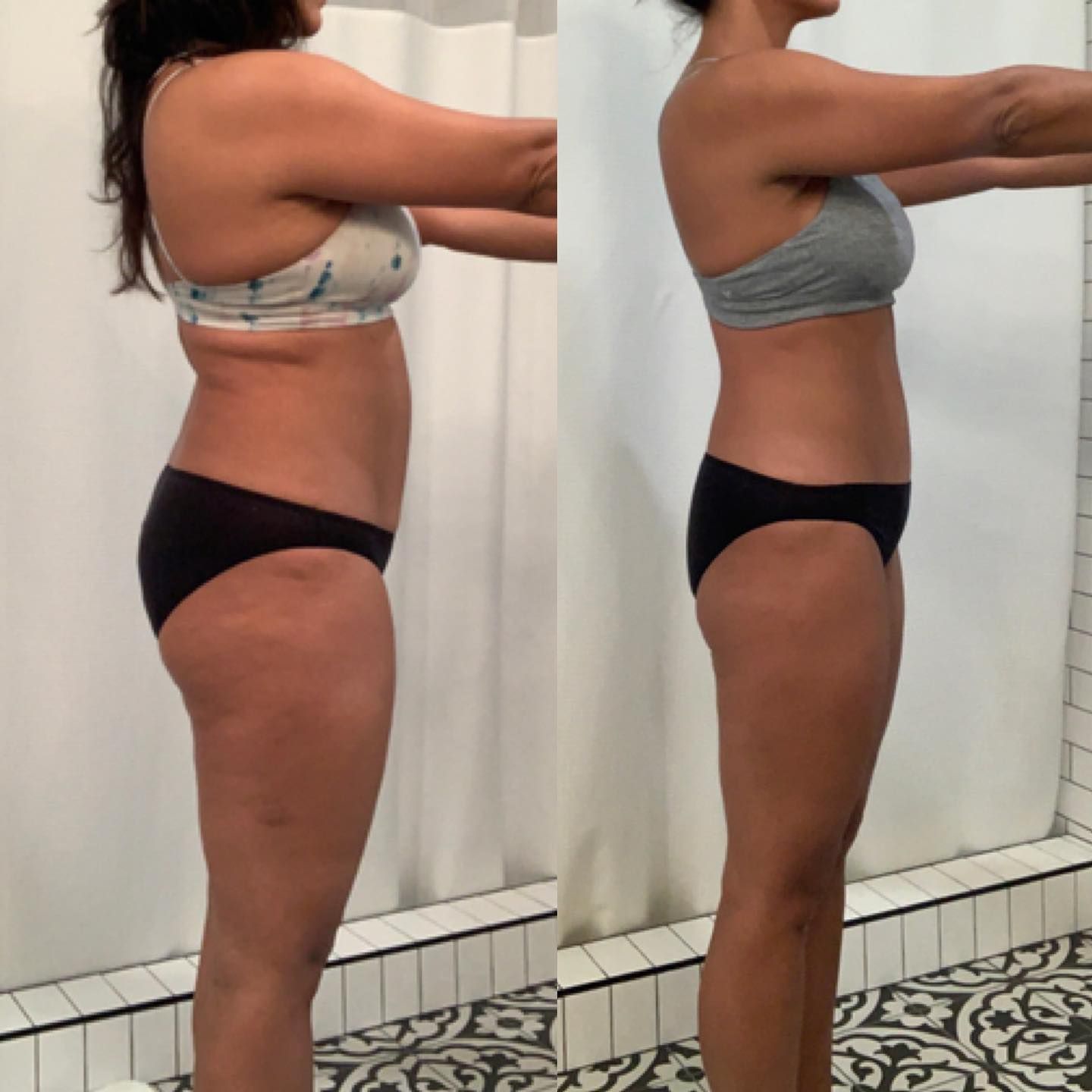 Side-by-side body profile photos in a bathroom, showing posture and midsection in sportswear.