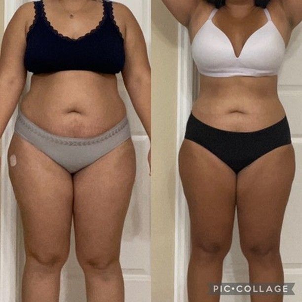 Side-by-side before-and-after body comparison in underwear, showing slimmer waist and toned legs.