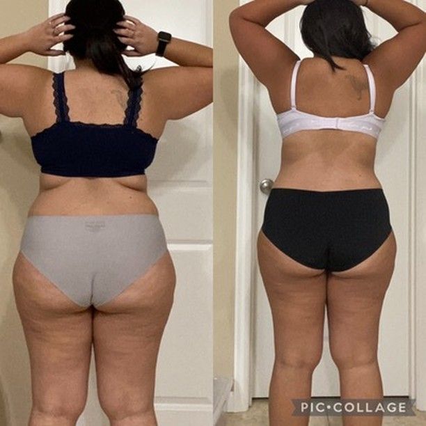 Back view comparison of a person in underwear, showing body shape in before-and-after poses.