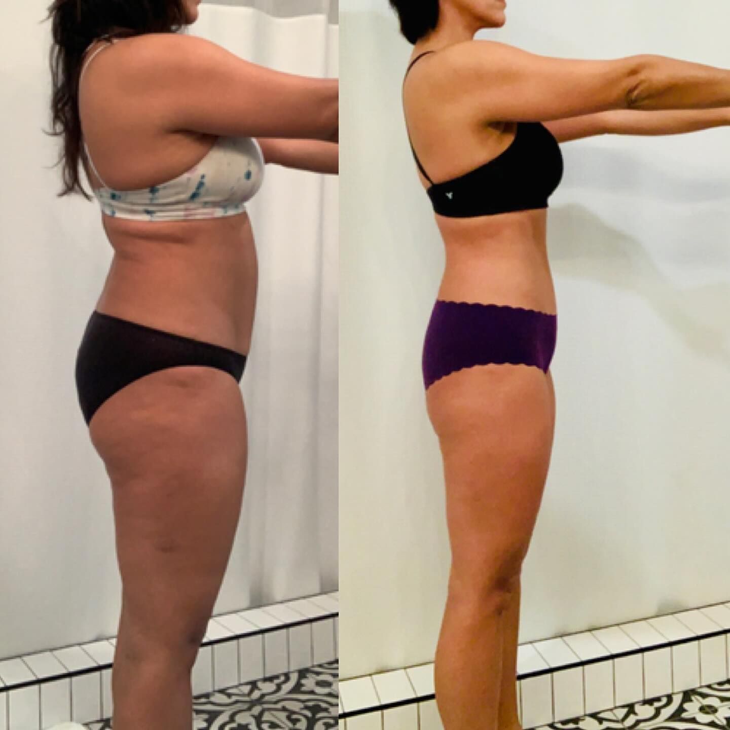 Side-by-side body profile comparison of the same person in black and purple underwear, standing with arms extended.