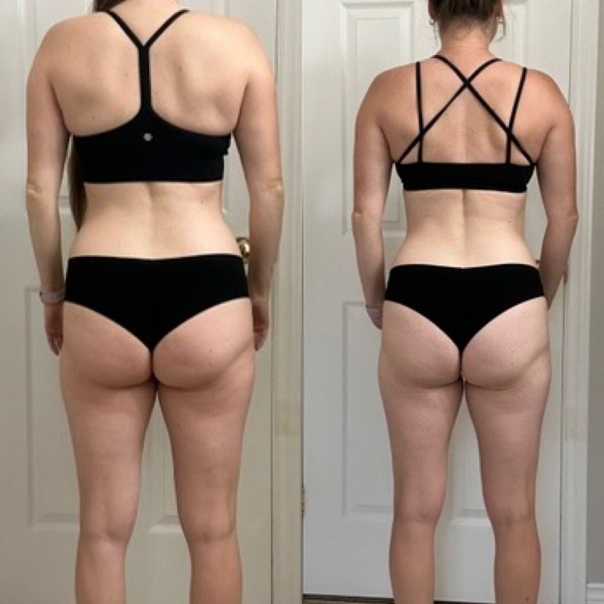 Back view comparison of a person in black athletic underwear, showing a straighter posture on the right.