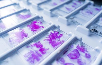 ONCORAMA - Transoperatorios ONCORAMA - Inmunohistoquímica