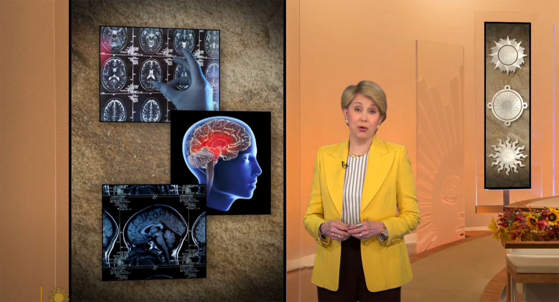 A woman in a yellow jacket is standing in front of a wall with pictures of a brain.