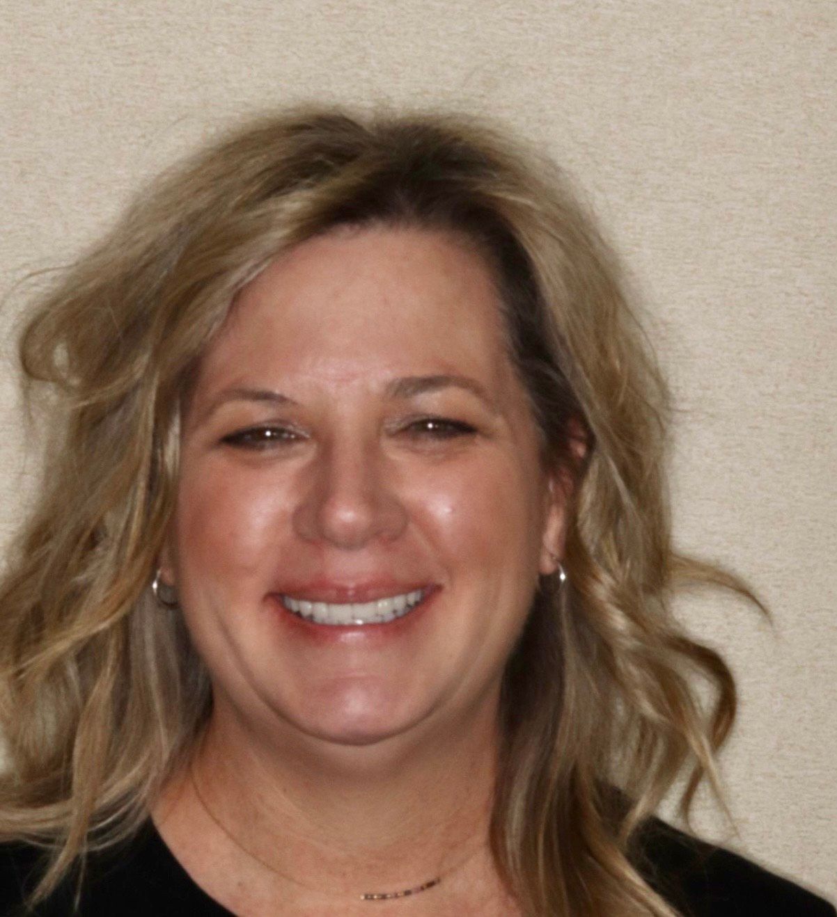 Smile Makeover in Westlake Dental Care Sterling VA