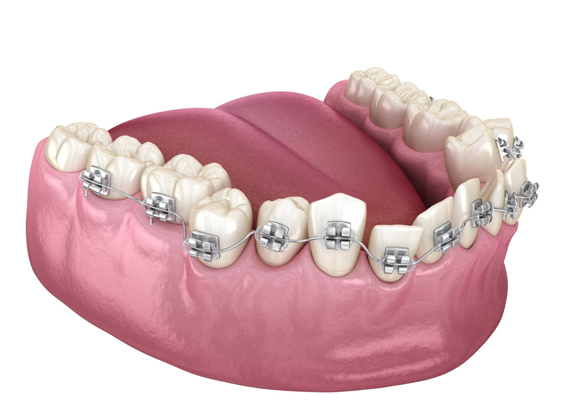 Orthodontic Dentist in Sterling VA Potomac Falls, Ashburn