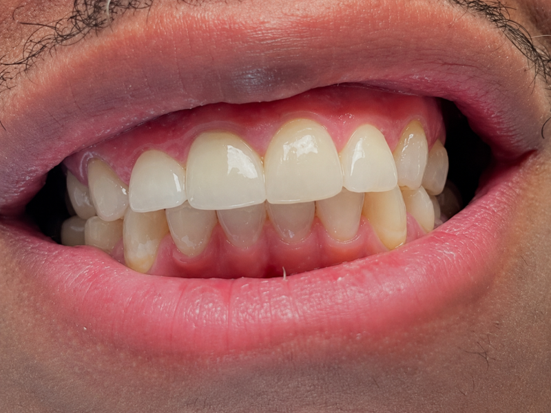 Friddle Dental After