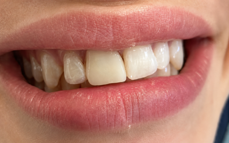 Friddle Dental After