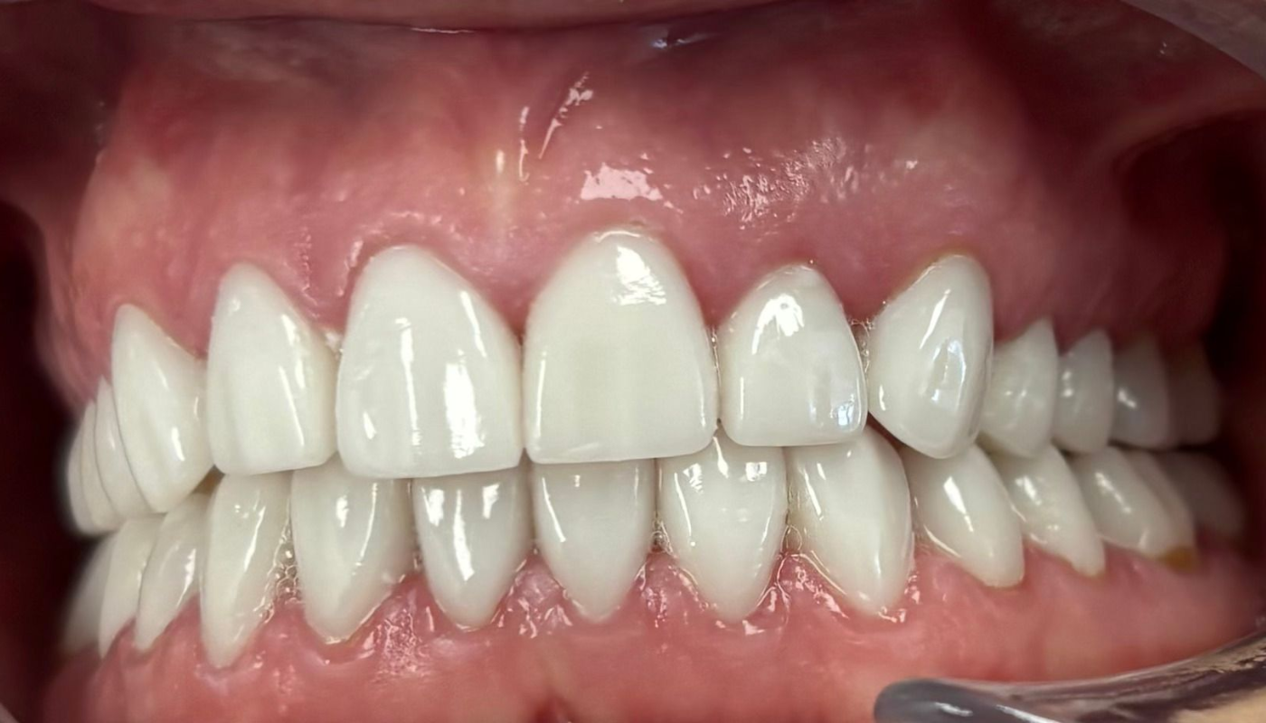 Friddle Dental After