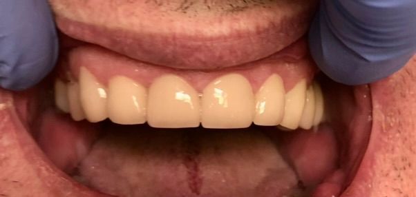 Friddle Dental After