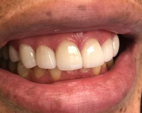 Friddle Dental After