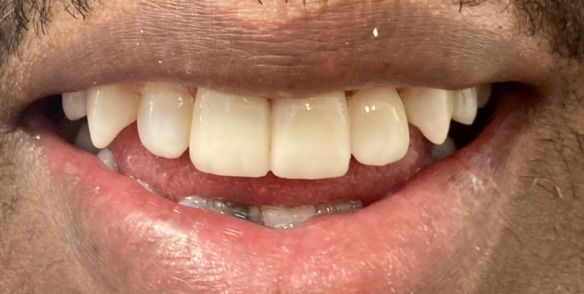 Friddle Dental After