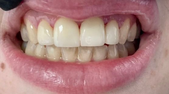 Friddle Dental After