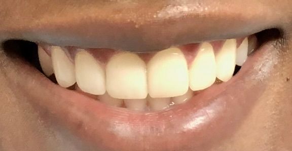 Friddle Dental After