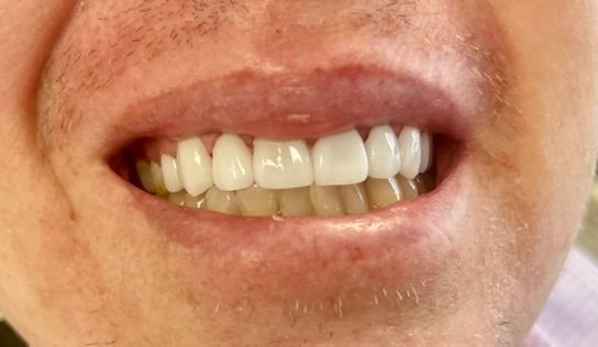 Friddle Dental After
