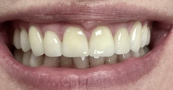 Friddle Dental After
