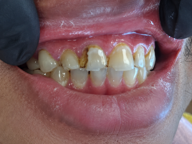 Friddle Dental Before