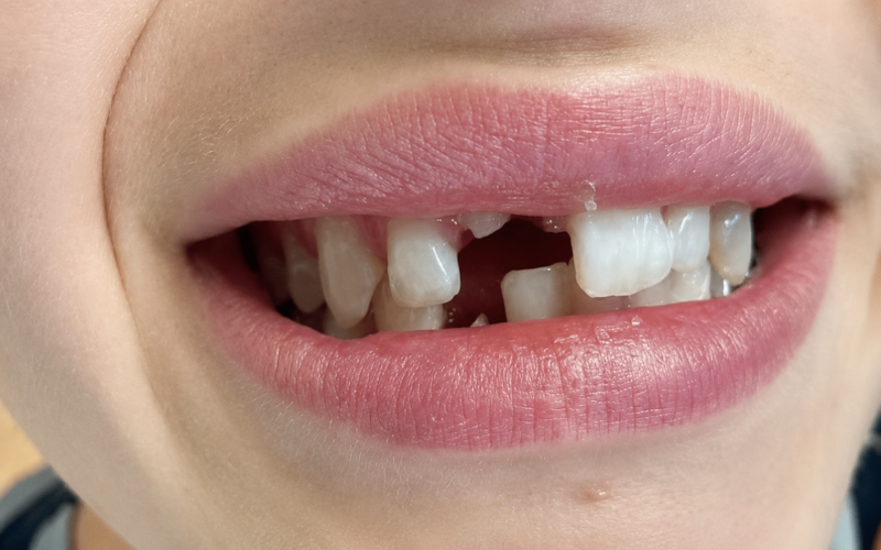 Friddle Dental Before