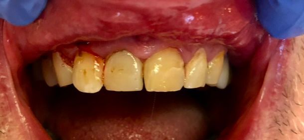 Friddle Dental Before