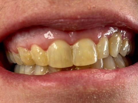 Friddle Dental Before