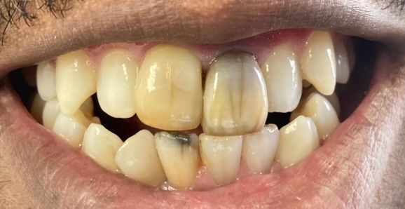 Friddle Dental Before