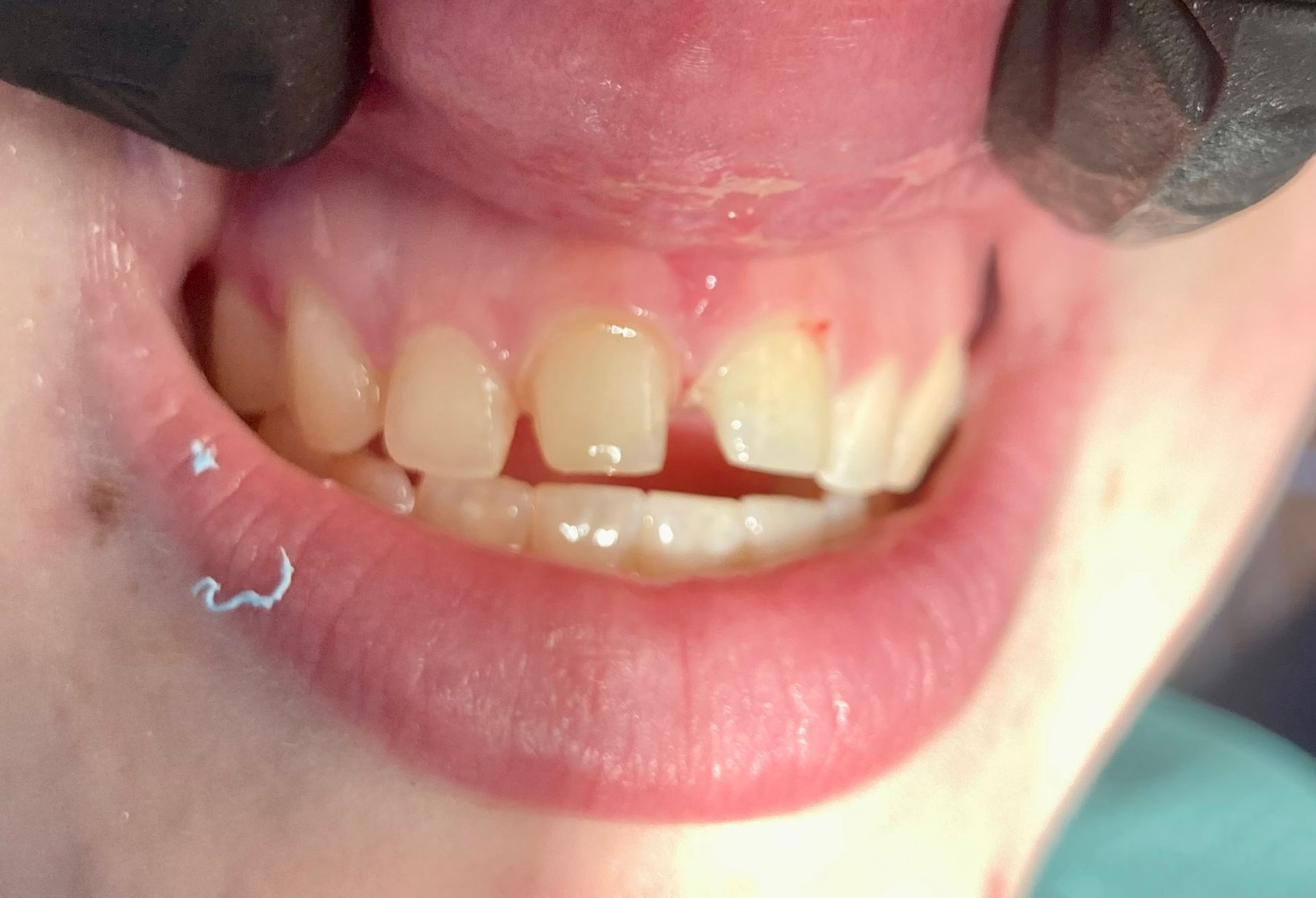 Friddle Dental Before