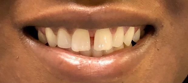 Friddle Dental Before