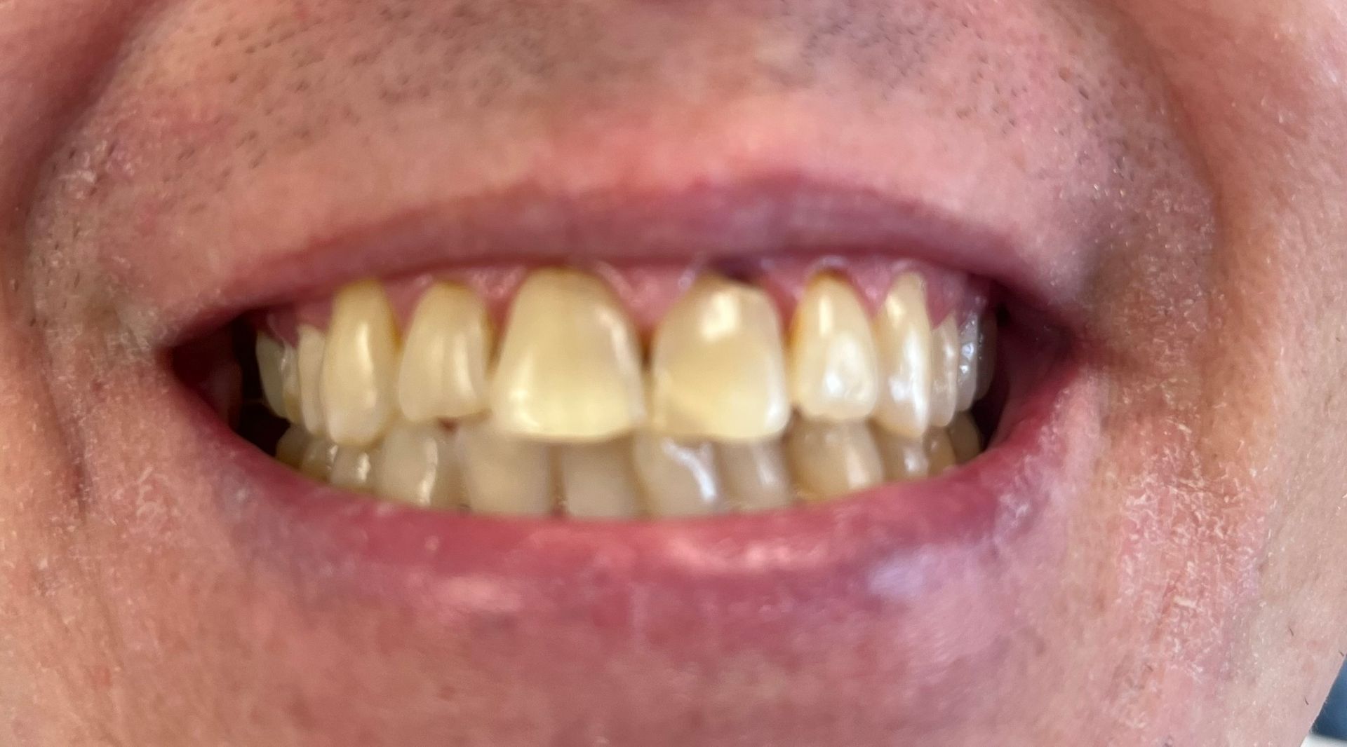 Friddle Dental Before