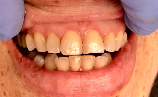 Friddle Dental Before