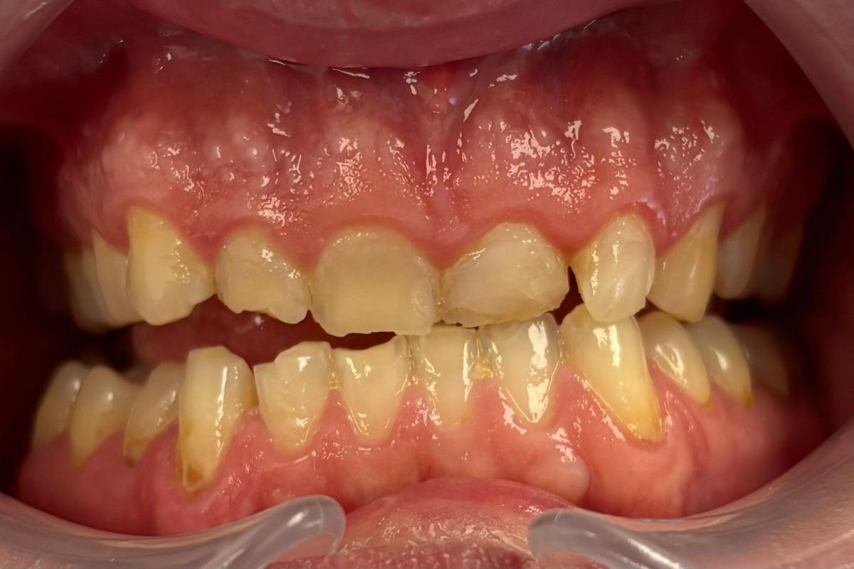 Friddle Dental Before