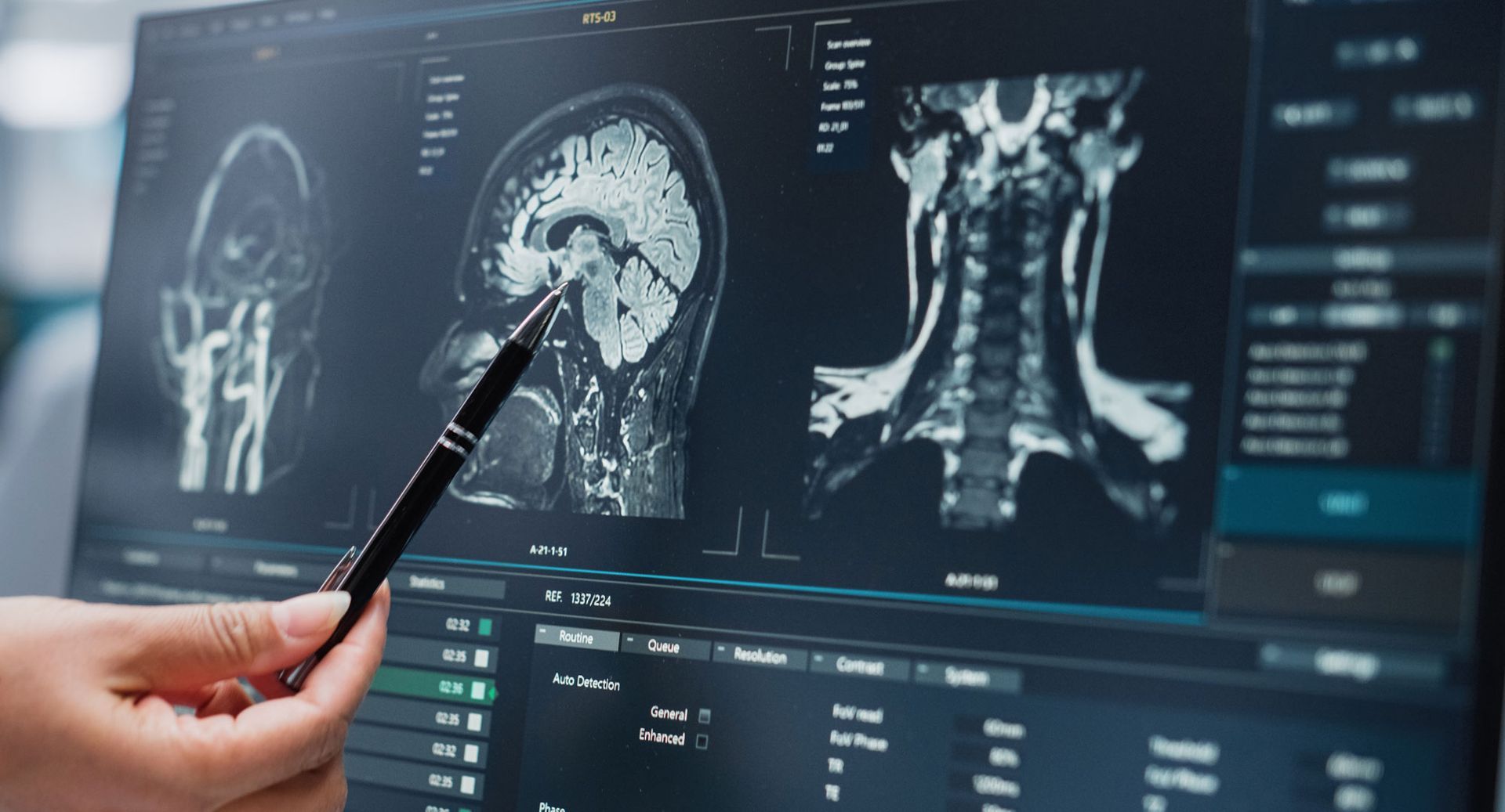 DEMENCIAS