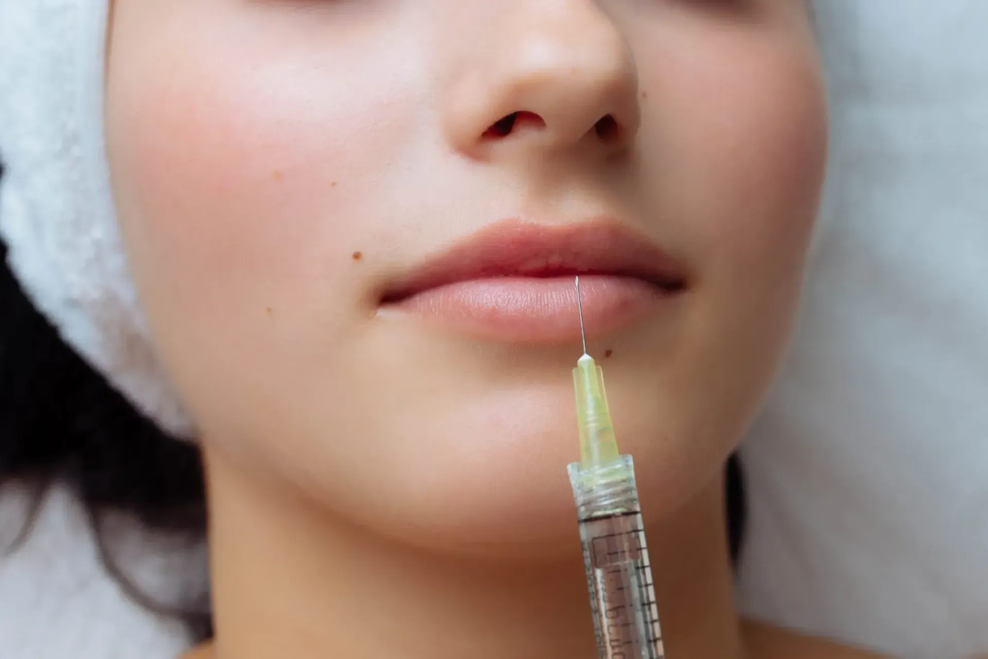 Woman receiving lip filler injection. Syringe near lips.