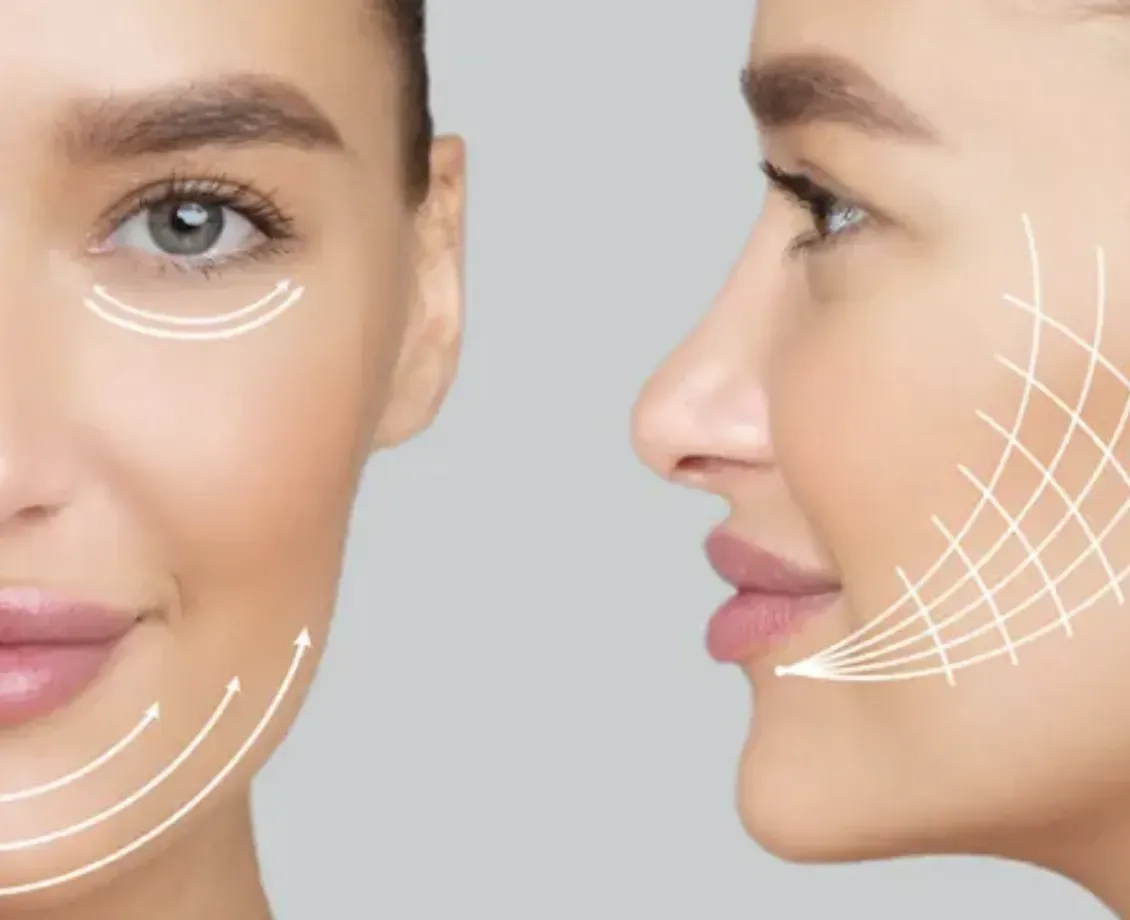 Woman's face split in two: front with lift lines, side with grid overlay, likely for cosmetic procedure.