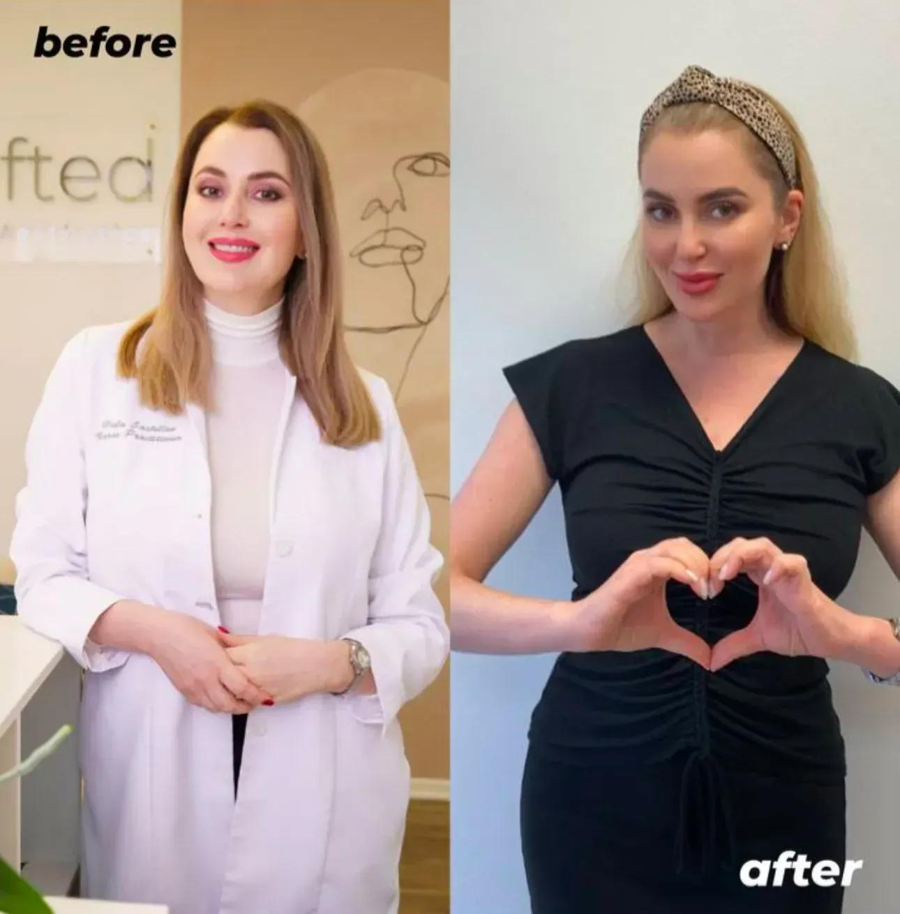 Before and after weight loss with Hula Castellon, FNP, MSN, and owner of Uplifted Aesthetics  