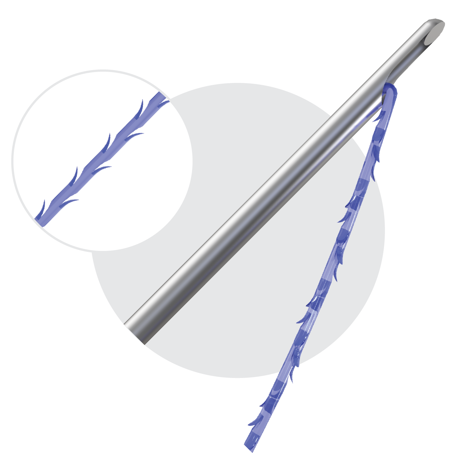 PDO Thread with blue barbed thread; used for non-surgical skin lifting.